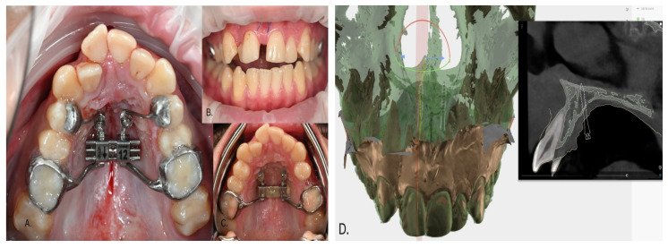 Figure 13