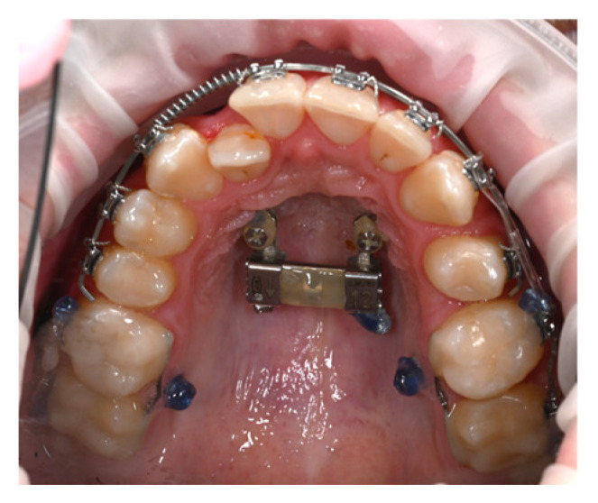 Figure 14