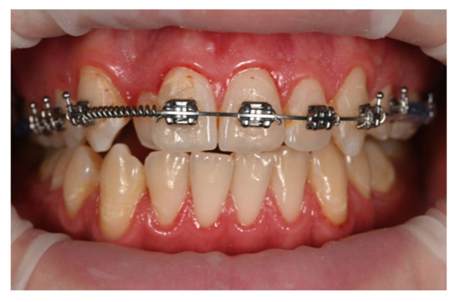 Figure 15