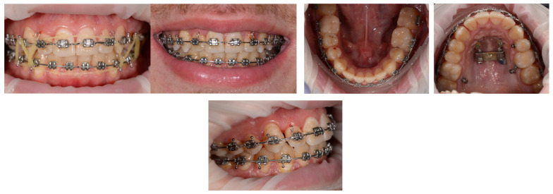 Figure 16