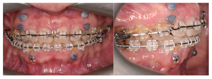 Figure 18