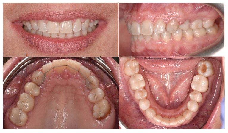 Figure 19