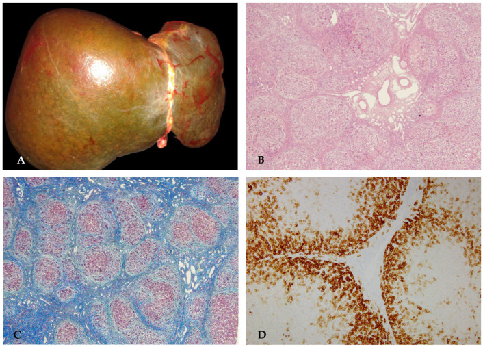 Figure 12