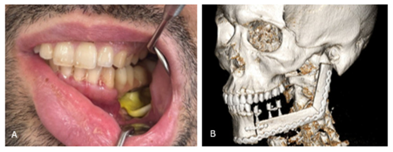 Figure 10