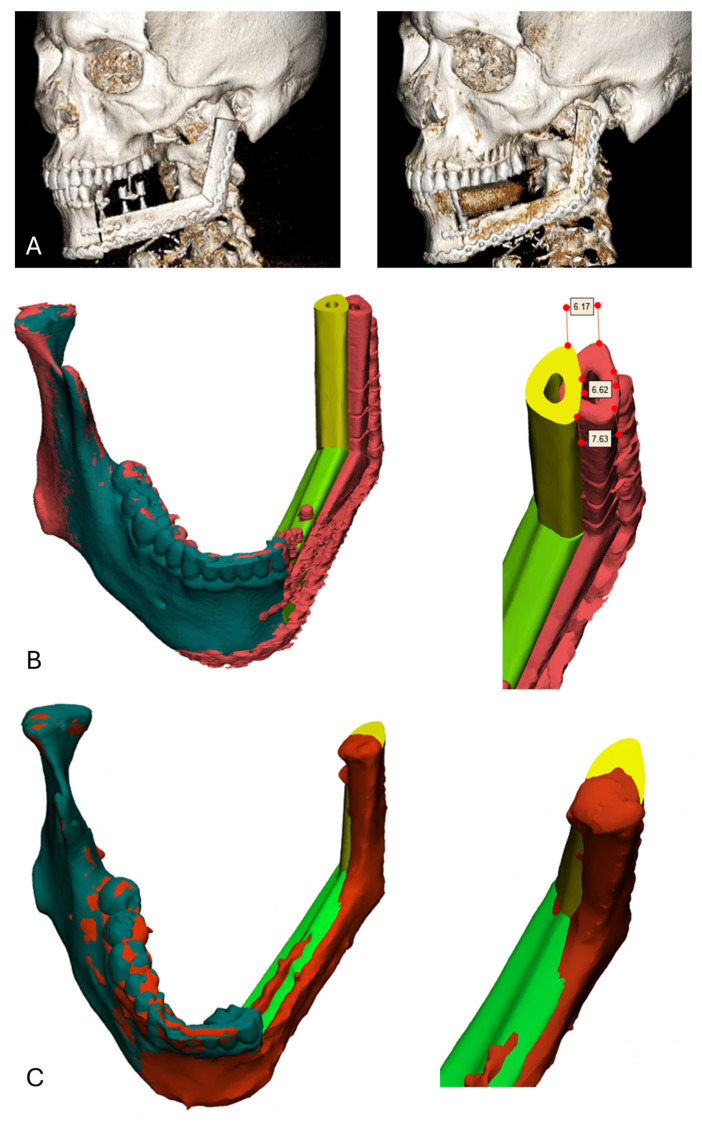 Figure 11