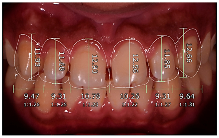 Figure 4