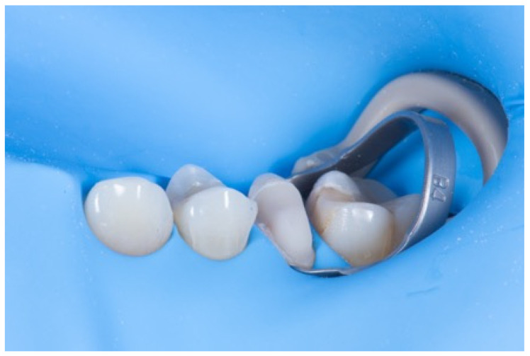 Figure 10