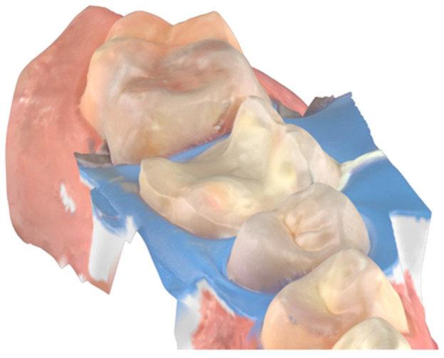 Figure 12