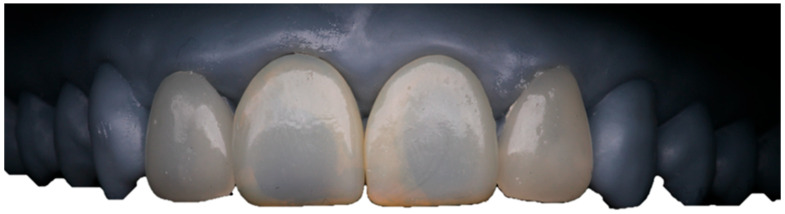 Figure 12