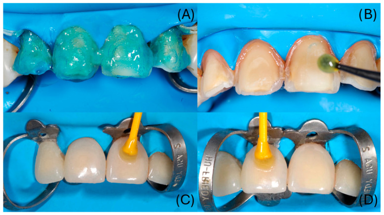 Figure 13