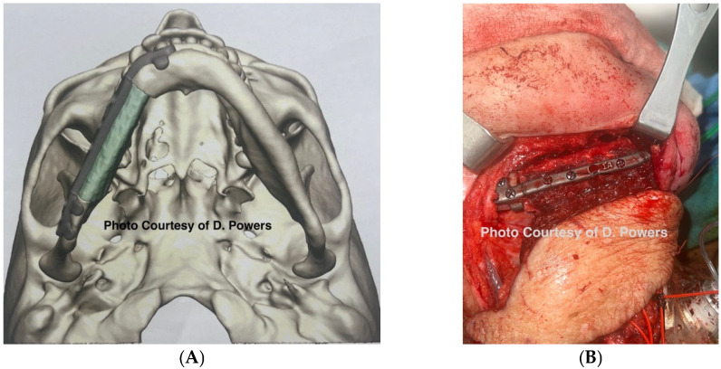 Figure 14