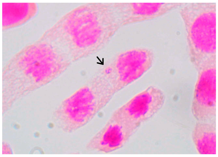Figure 17