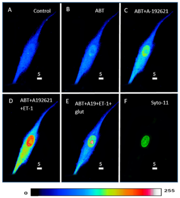 Figure 11