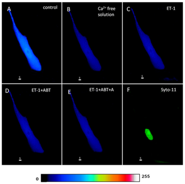 Figure 13
