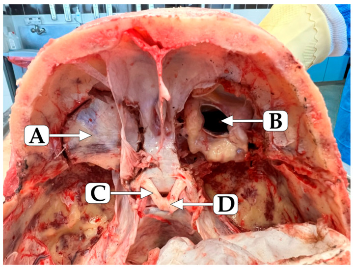 Figure 10
