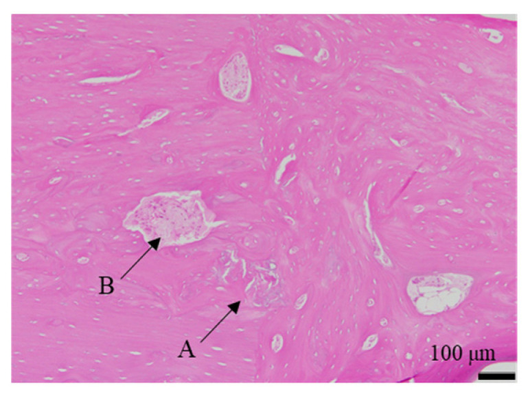 Figure 17