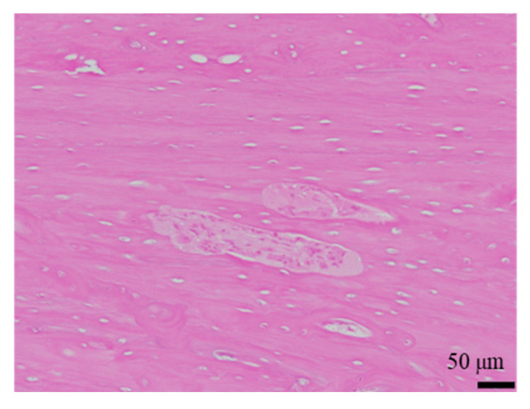 Figure 18