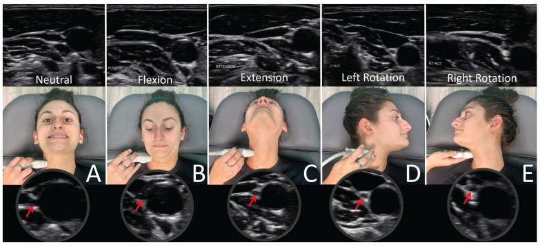 Figure 17