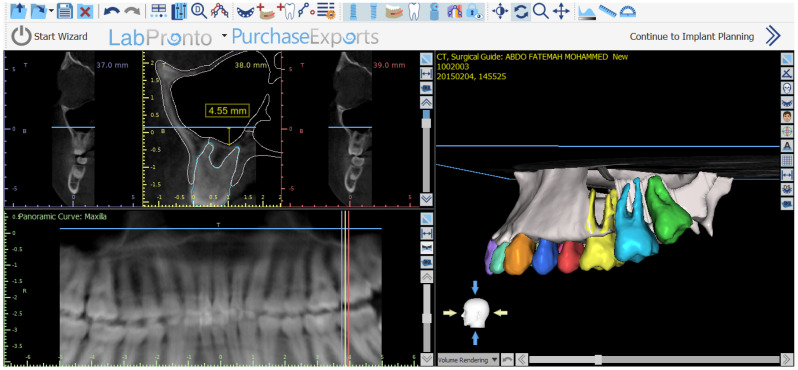 Figure 2