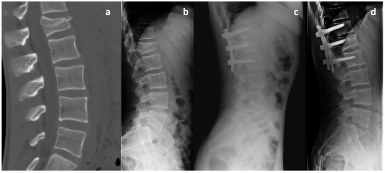 Figure 2