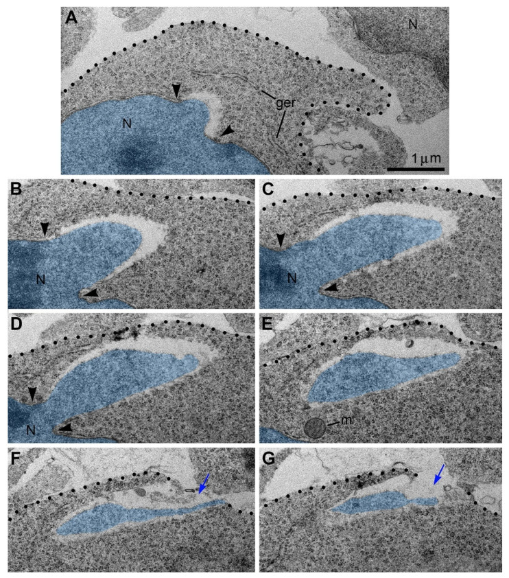 Figure 11