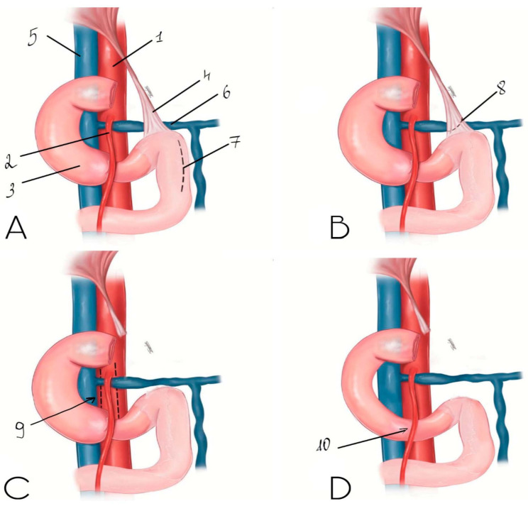 Figure 9
