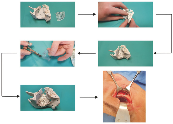 Figure 14