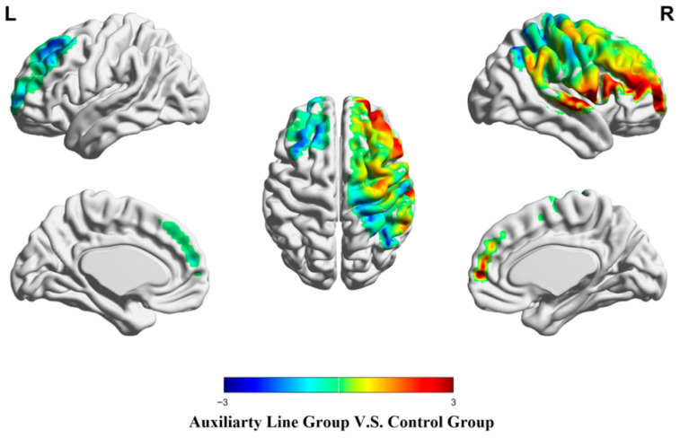 Figure 12