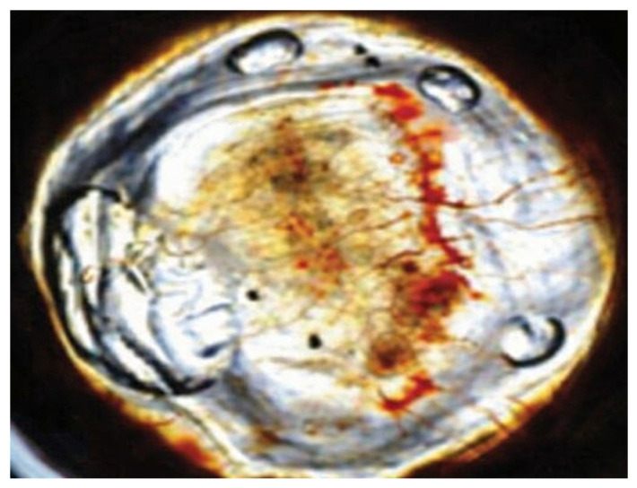 Figure 9