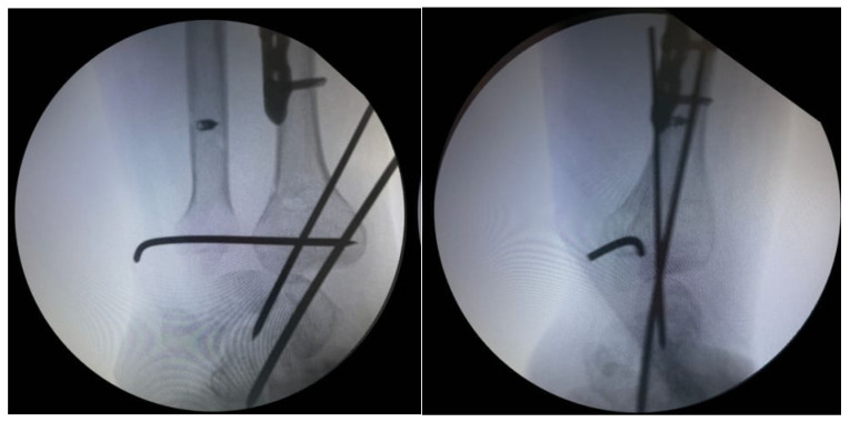 Figure 11