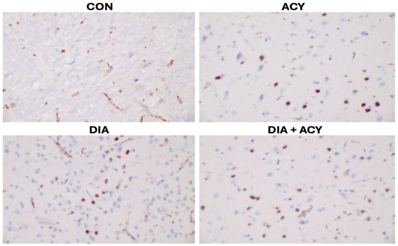 Figure 14