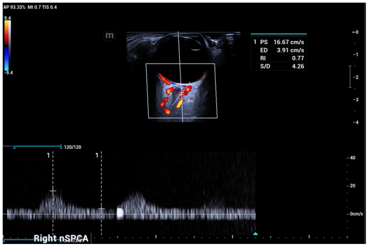 Figure 6