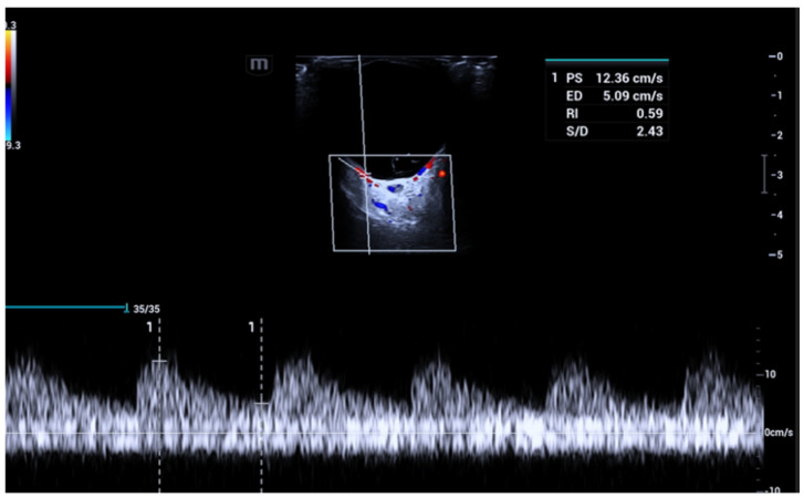Figure 7