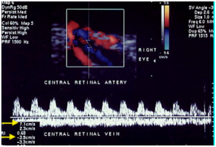 Figure 11