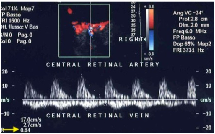 Figure 12