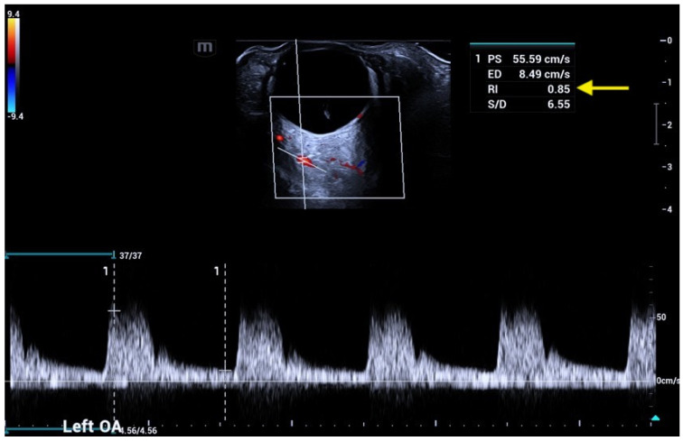 Figure 13
