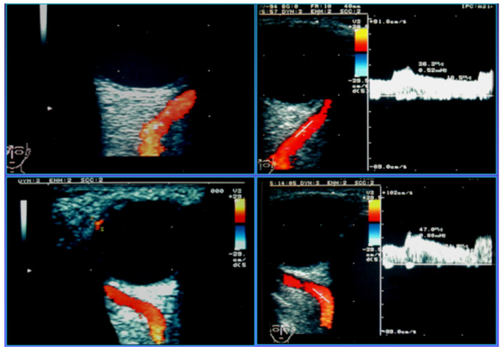 Figure 14