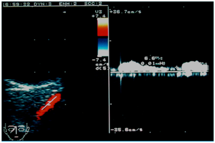 Figure 15