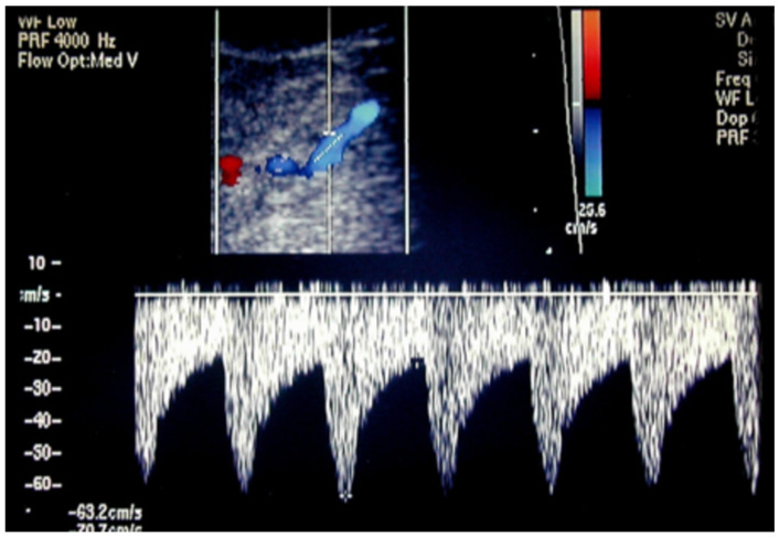 Figure 16