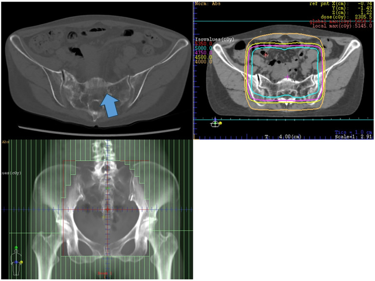Fig 1