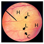 Figure 10
