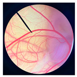 Figure 13
