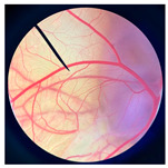 Figure 18