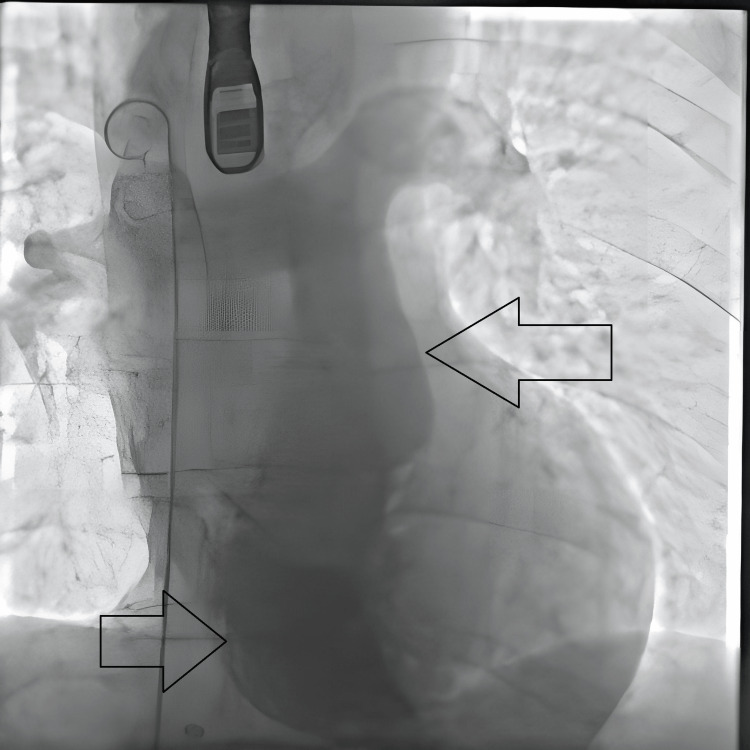 Figure 5