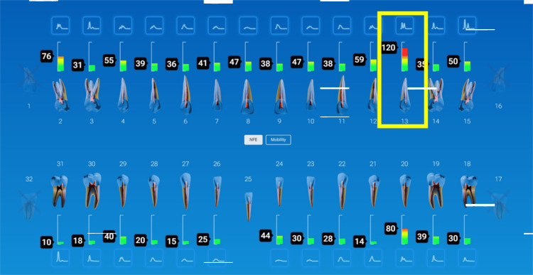 Figure 10