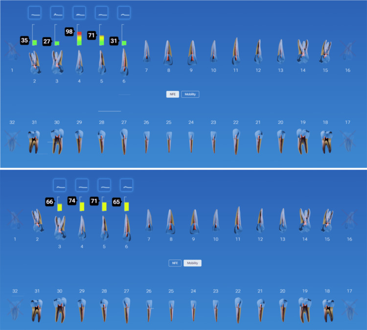 Figure 13