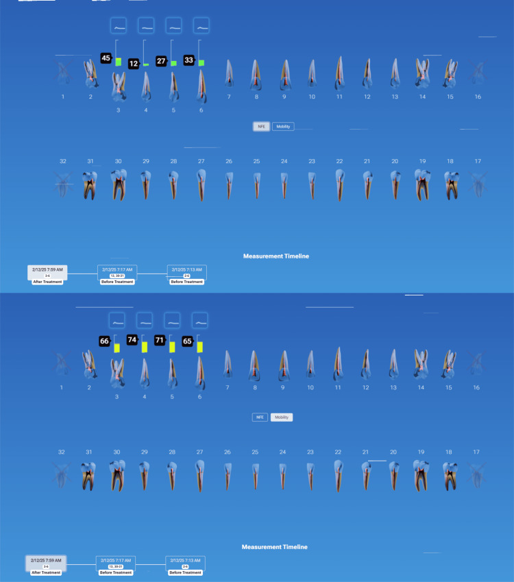 Figure 14