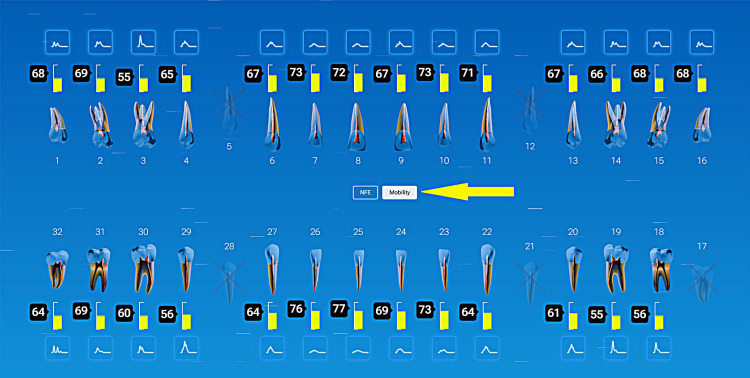 Figure 15