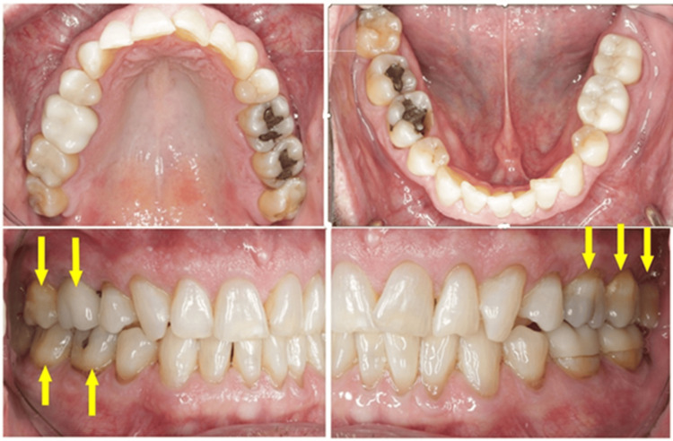 Figure 17