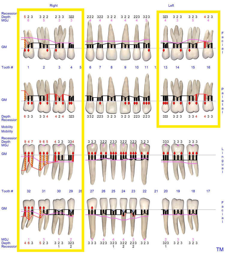 Figure 18